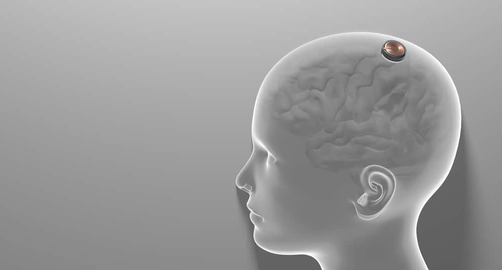 O implante da Neuralink pode estar perto dos testes humanos, mas a comunidade científica se mostra preocupada com a ideia de implantar um chip no cérebro alheio sem uma longa discussão