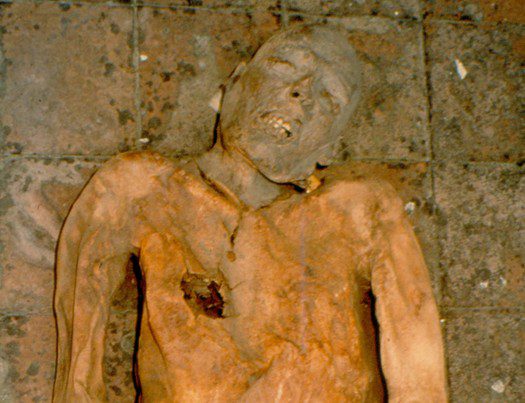 Reconstruction of the genome of bacteria found in a 16th century Italian mummy (Photo: Department of Paleopathology, University of Pisa)