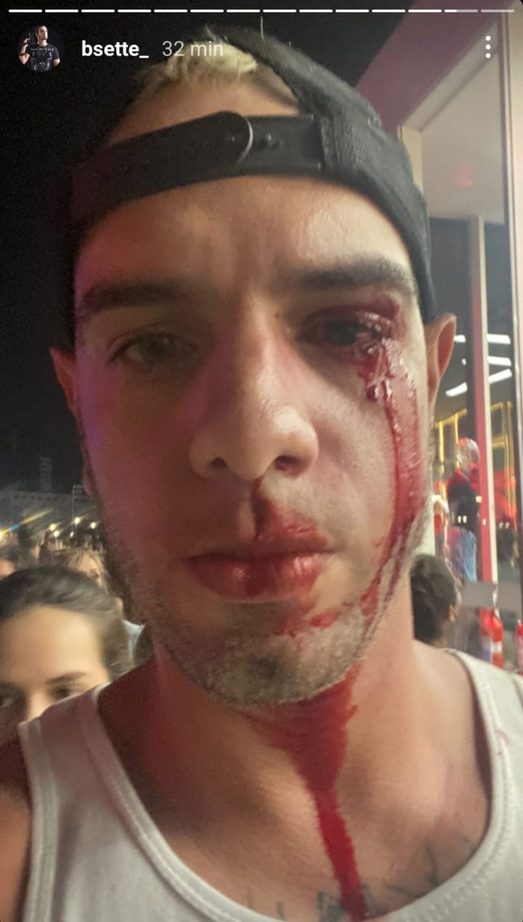 A photographer was assaulted after colliding with a girl sitting on artificial turf in Roc, Rio |  Rock in Rio 2022