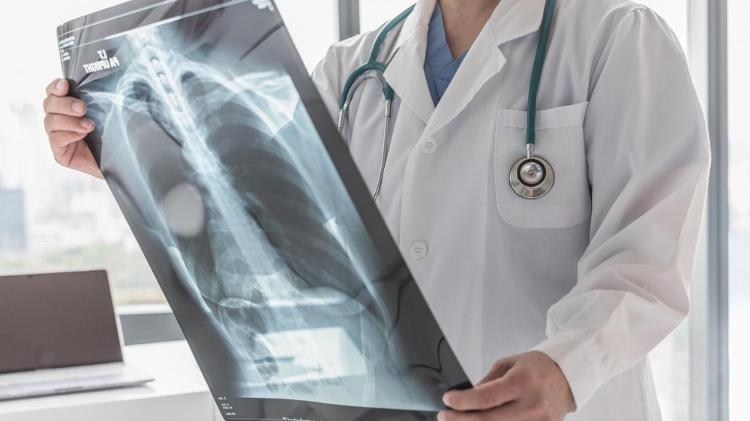 Tuberculosis, lung x-ray - Chinnapong / iStock - Chinnapong / iStock