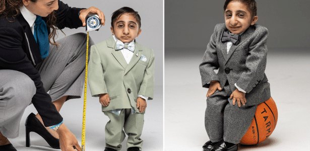 65 cm is considered the shortest man in the world